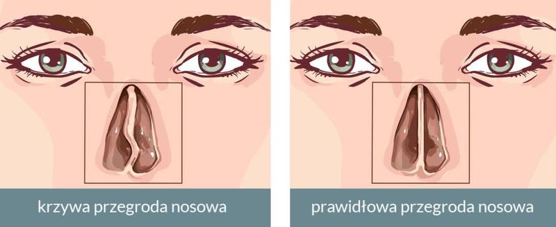 Oddzielenie salonu od jadalni