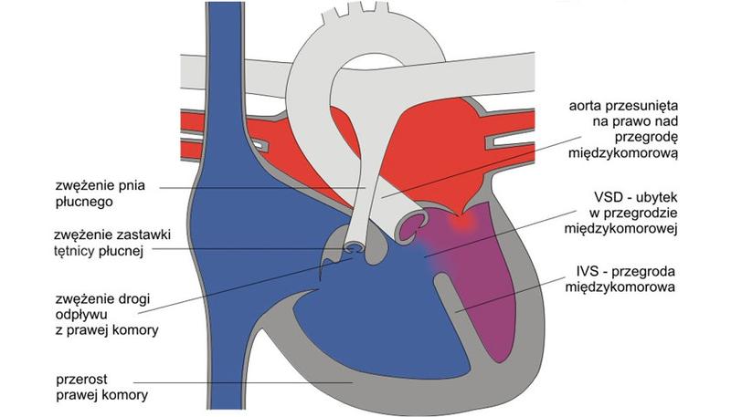 Strefowanie otwartej przestrzeni